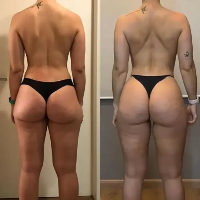 Antes e depois de aluna do PPG