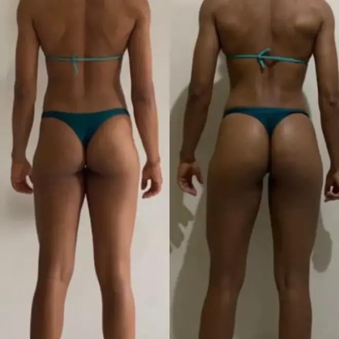 Antes e depois de aluna do PPG